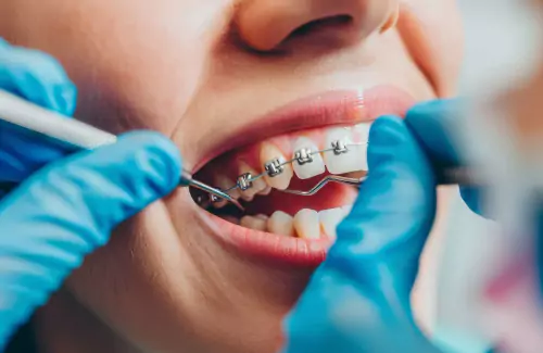 Dental health article