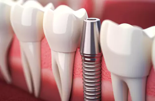 Dental health article