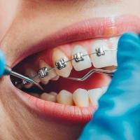 Dental health article