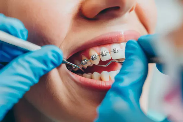Dental service