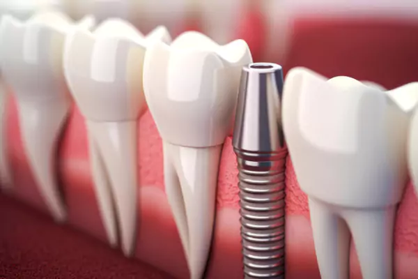 Dental service
