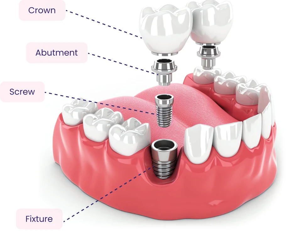 Dental service